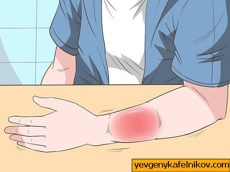 Obrázek s názvem Make a Sling for Your Arm Krok 16