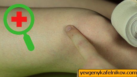 Wrap Your Knee Step 9 이미지